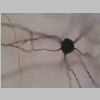 Neuronas Golgi 39.jpg